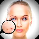 Face Enhancer: Blemish Remover